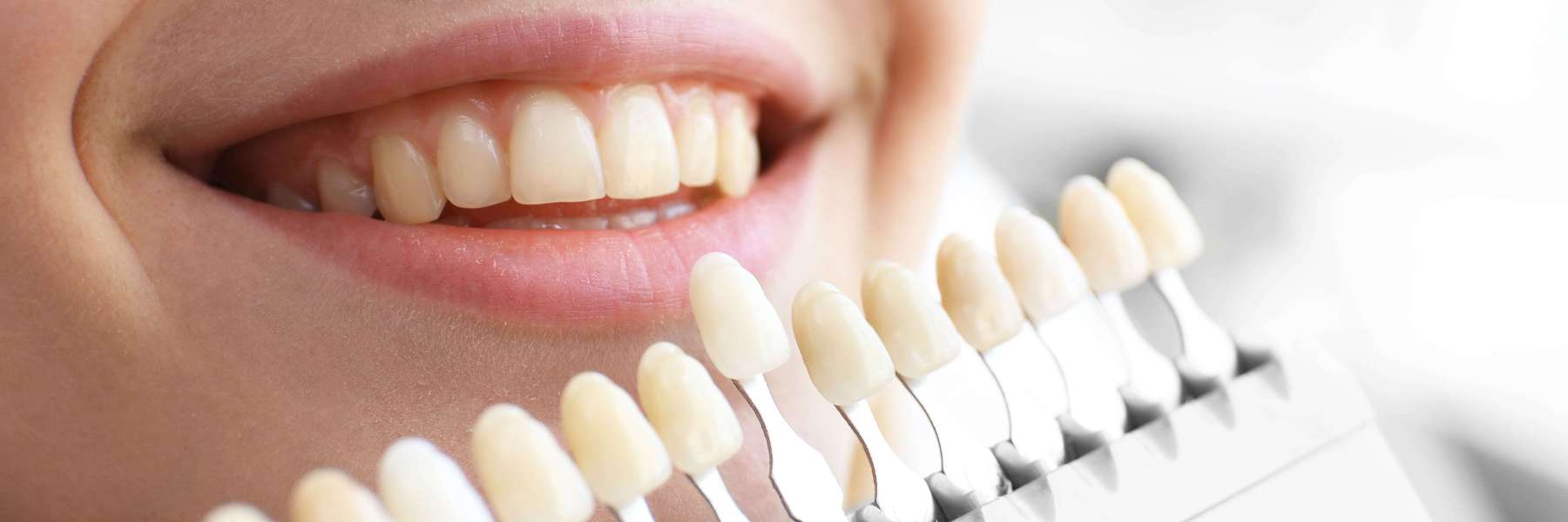 Cosmetic Dentistry | Dentist